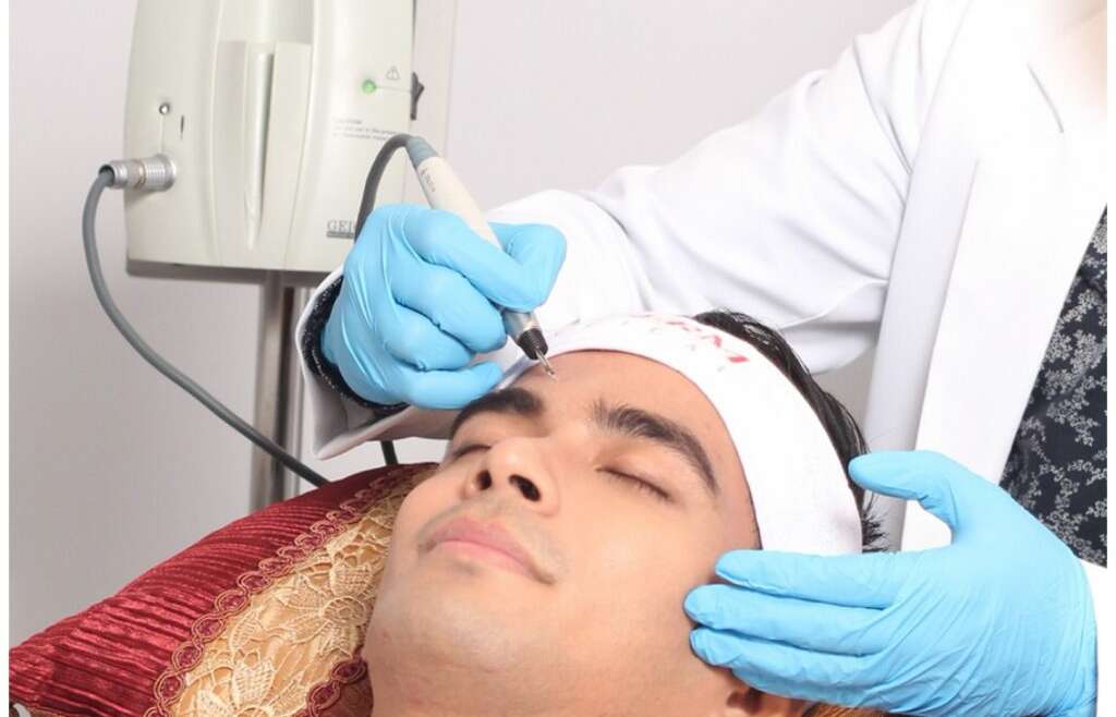 electrocautery-treatment-male
